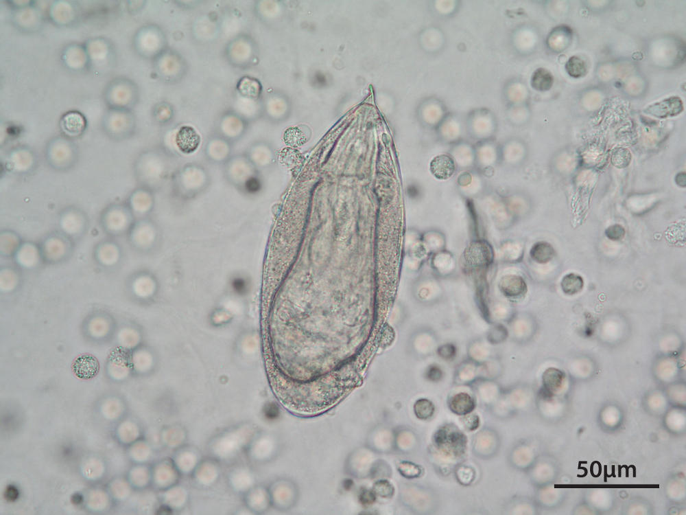 Parasite genetics may hold key to schistosomiasis treatment