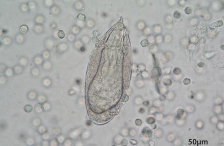 Parasite genetics may hold key to schistosomiasis treatment