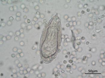 A magnified photo of Schistosoma haematobium