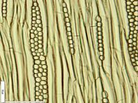 Tangential section