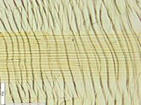 Radial section