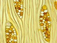 Tangential section