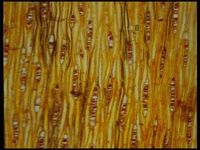 Tangential section