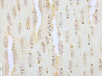 Tangential section