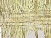 Radial section