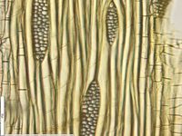 Tangential section