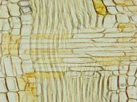 Radial section