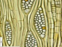 Tangential section