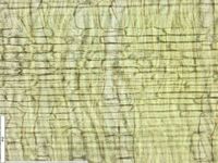 Radial section