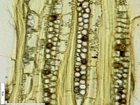 Tangential section