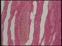 Tangential section