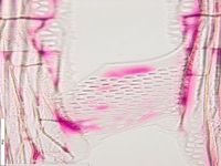 Radial section
