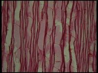 Tangential section