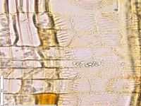 Radial section