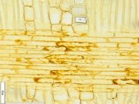 Radial section