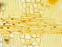 Radial section