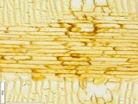 Radial section