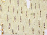 Tangential section