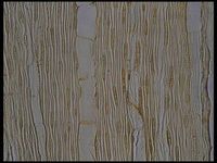 Tangential section