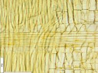 Radial section