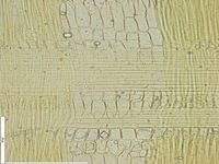 Radial section