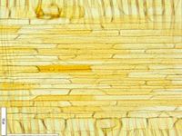 Radial section
