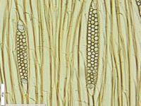 Tangential section
