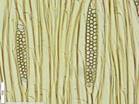 Tangential section