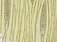Tangential section