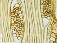 Tangential section