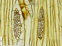 Tangential section