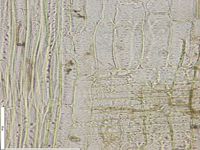 Radial section