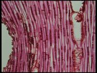 Tangential section