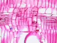 Radial section