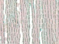 Tangential section