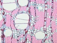Transversal section
