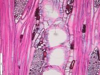 Tangential section