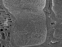 Radial section