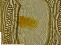 Tangential section