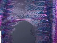 Radial section