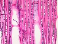 Tangential section