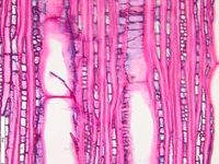 Tangential section