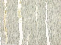 Tangential section