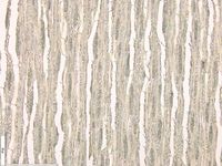 Tangential section