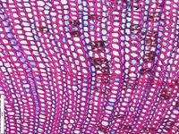 Transversal section