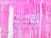Radial section