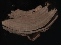 Scan transversal view