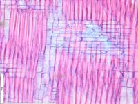 Radial section