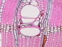 Transversal section