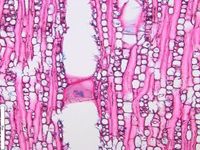 Tangential section